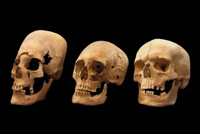 'Video thumbnail for Foreign Eggheads: Pointy-Skulled Women Were Immigrant Brides'