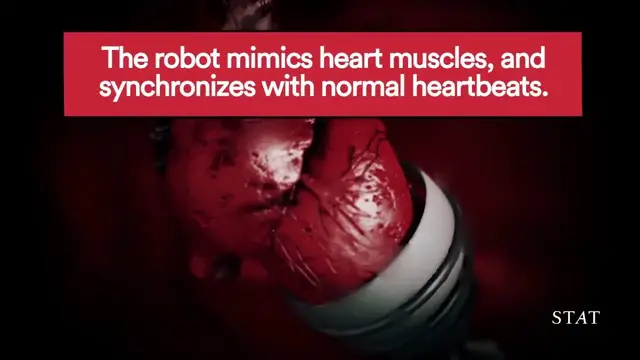 'Video thumbnail for This robot hugs hearts to keep them pumping blood'