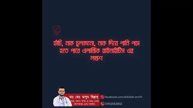 'Video thumbnail for Dr. Md. Masum Billah ENT and Head - Neck Surgeon - BD- Allergic Rhinitis'