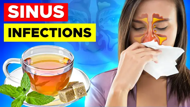 'Video thumbnail for How To Get Rid of Sinus Infections'