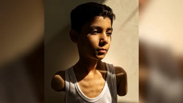 'Video thumbnail for Image of Gaza airstrike survivor wins 2025 World Press Photo of the Year'