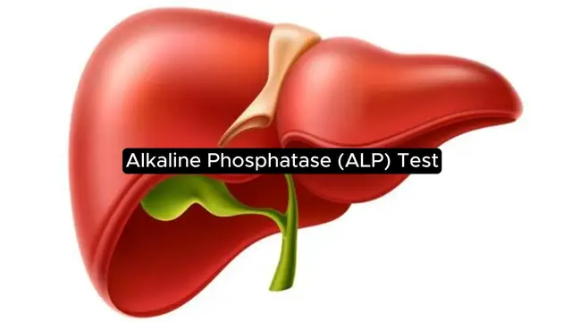 'Video thumbnail for What is ALP Test?- Normal Range, High & Low Levels, Clinical Significance'