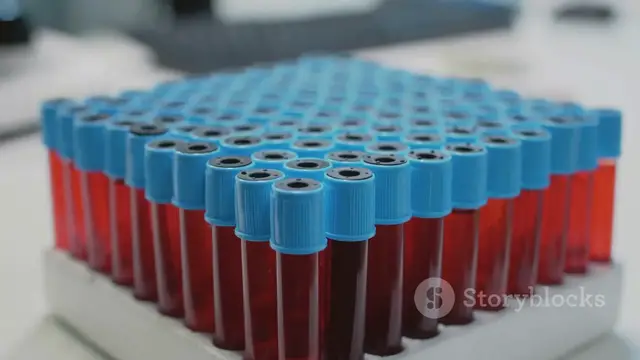 'Video thumbnail for Cholesterol Discovery Medical Explainer'