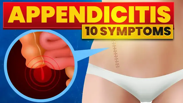 'Video thumbnail for ⚡ 10 Signs of Appendicitus (Don't Ignore)'