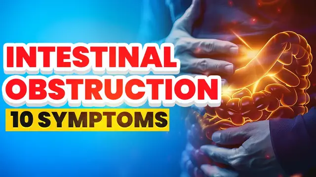 'Video thumbnail for ⚡ 10 Signs of Intestinal Obstruction (Don't Ignore)'