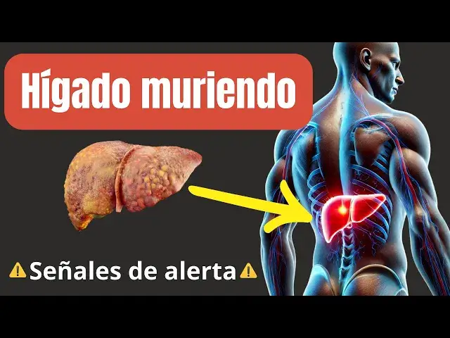 'Video thumbnail for 13 Signos Extraños de DAÑO en el HÍGADO ¡Presta atención!'