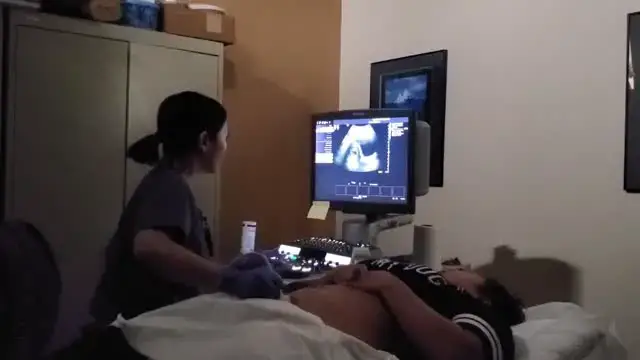 'Video thumbnail for Ultrasound Student Stunned To Discover Sister Is Pregnant During Scan | Happily TV'
