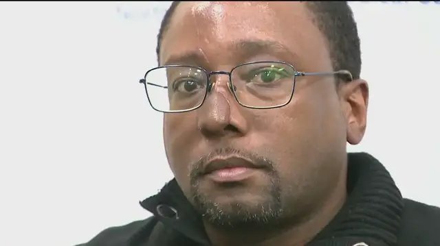'Video thumbnail for Long Island man receives life-changing surgery'