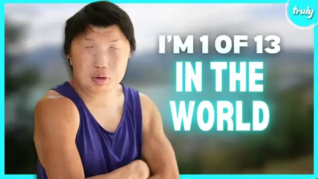 'Video thumbnail for My Rare Condition Makes My Face Look Like A Mask | BORN DIFFERENT'