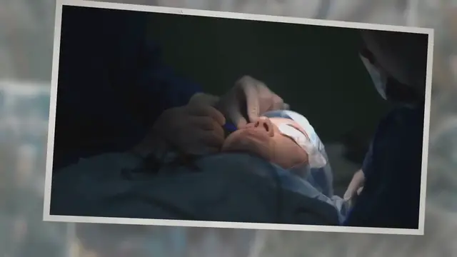 'Video thumbnail for Hidden Meaning You Need To Know About Surgery Dreams'