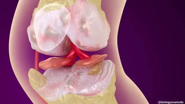 'Video thumbnail for Disorders of Muscular and Skeletal System'
