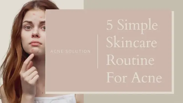 'Video thumbnail for Simple Skincare Routine for ACNE'
