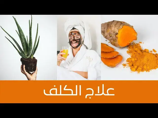 'Video thumbnail for How to Treat Melasma Naturally علاج الكلف بمكونات سهلة وطبيعية، ستلاحظين الفرق بعد اول استعمال'