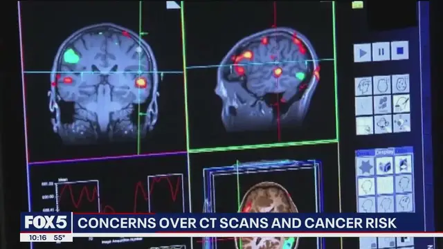 'Video thumbnail for Concerns over CT scans and cancer risk'