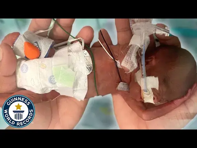 'Video thumbnail for Meet the most premature baby'