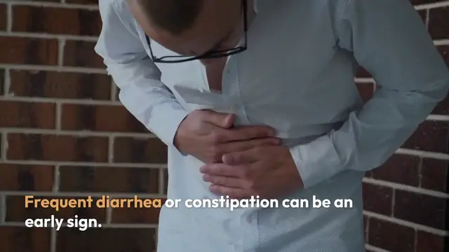 'Video thumbnail for Recognizing Colon Cancer Symptoms'