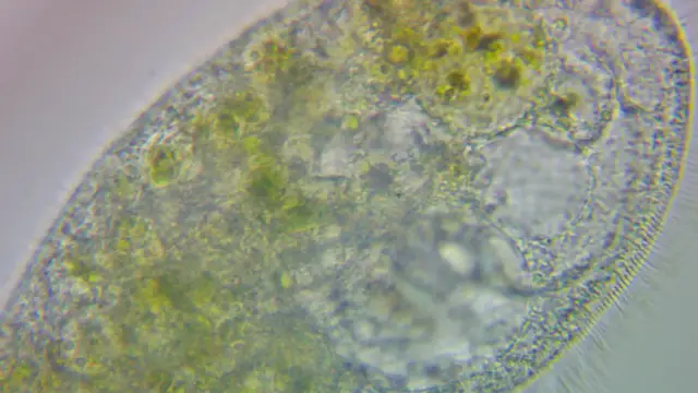 'Video thumbnail for Stentors and Their Cilia'