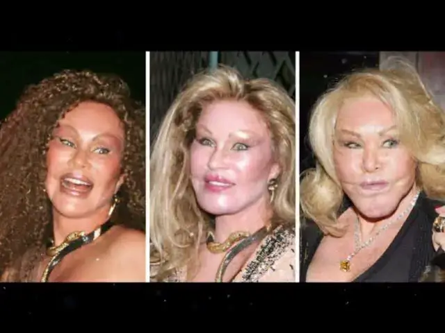'Video thumbnail for WHO IS JOCELYN WILDENSTEIN? CAUSE OF DEATH, AGE, HUSBAND, SURGERIES AND NET WORTH'