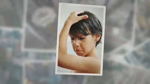 'Video thumbnail for True Meaning and Right Interpretation of Dream About Bumps'