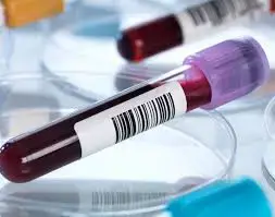 'Video thumbnail for  What is CBC Test , FBC, CP | Normal Range, Clinical Significance'