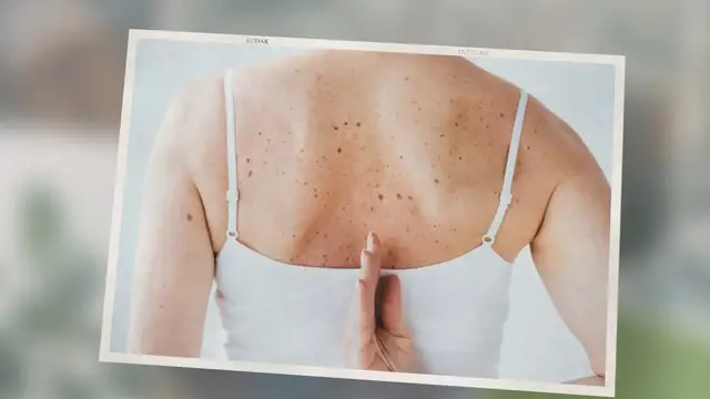 'Video thumbnail for Dreams About Things Growing Out of Skin'