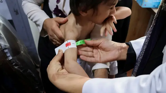 'Video thumbnail for Afghan children face alarming malnutrition as aid cuts and crisis deepen'