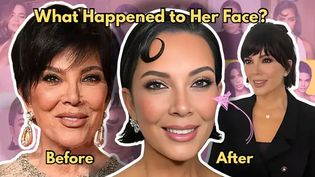 'Video thumbnail for Kris Jenner’s Uncanny Facelift & the Dystopian Future of Aging'