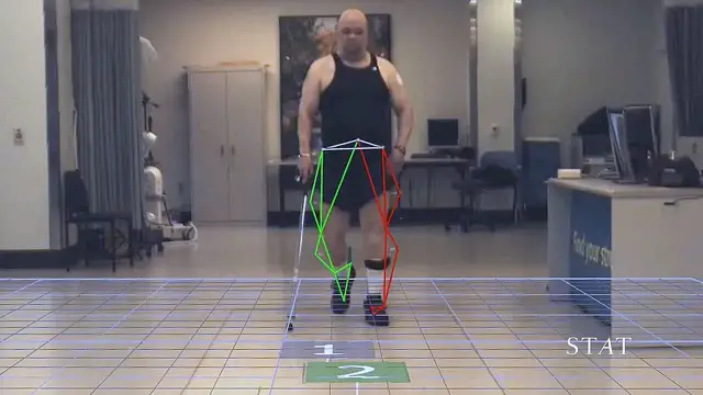 'Video thumbnail for Hollywood motion capture technology finds a new role in hospital rehab'