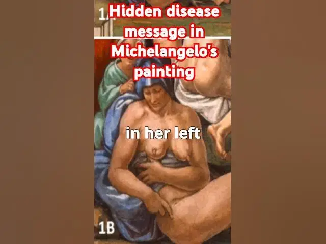'Video thumbnail for Hidden Disease in Michelangelo’s Sistine Chapel #artmysteries #michelangelo #sistinechapel'