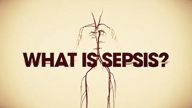 'Video thumbnail for What is sepsis? Here's what you need to know.'