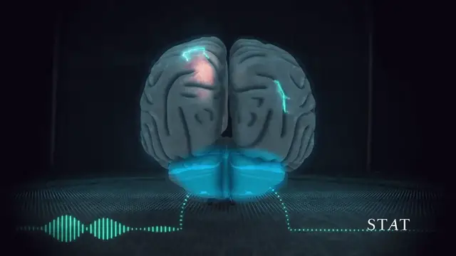 'Video thumbnail for This is how music gets into your brain'