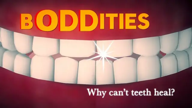 'Video thumbnail for Boddities | Episode 9 | Why can't teeth heal?'