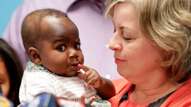 'Video thumbnail for Doctors remove extra legs, spine from infant'