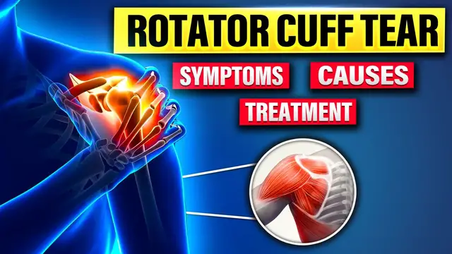 'Video thumbnail for Rotator Cuff Tear: Symptoms & Recovery'