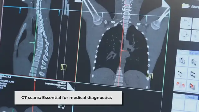 'Video thumbnail for CT Scan Abdomen and Pelvis with Contrast: A Comprehensive Guide | CPT Code, Procedure, and Benefits Explained'