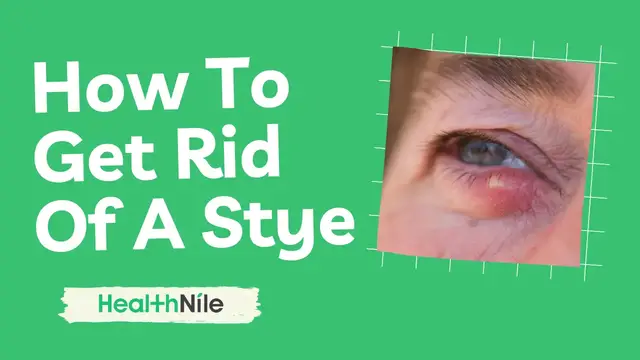 'Video thumbnail for How To Get Rid Of A Stye'