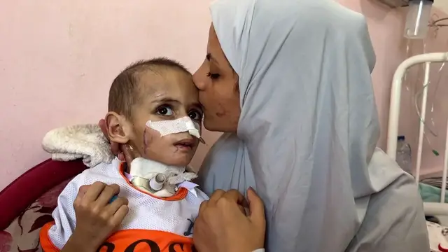 'Video thumbnail for Paralysed 3-year-old's suffering worsens after Israeli attack in Gaza'