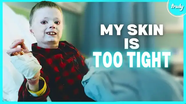 'Video thumbnail for My Skin Is Too Tight For My Body | BORN DIFFERENT'