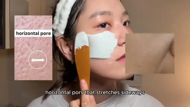 'Video thumbnail for How to get rid of large pores on cheeks (+permanently, at home)'