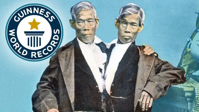 'Video thumbnail for The Dark History of the First 'Siamese' Twins'