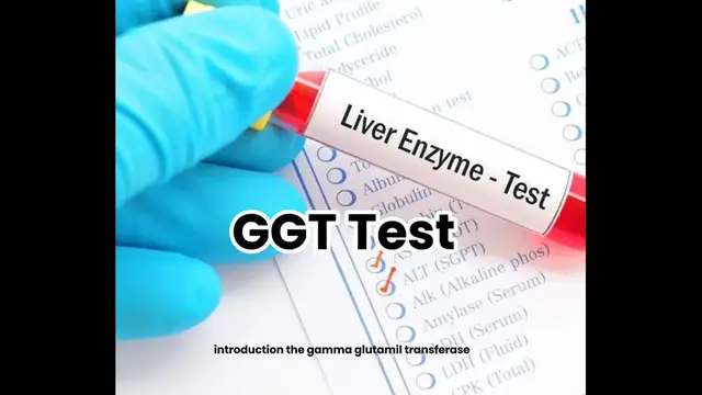 'Video thumbnail for What is the GGT Test? | Normal Range, Critical Values, and Clinical Significance'