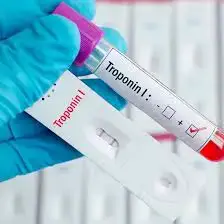 'Video thumbnail for Trop I Test | Is Your Heart in Danger? The Truth About the Troponin I Test!'