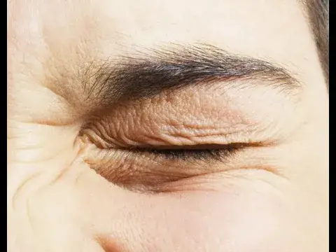 'Video thumbnail for Migraine and eye twitching - 6422, 1.22 PM'