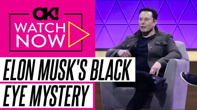 'Video thumbnail for Elon Musk's Mysterious Black Eye Sparks Speculation During White House Farewell'