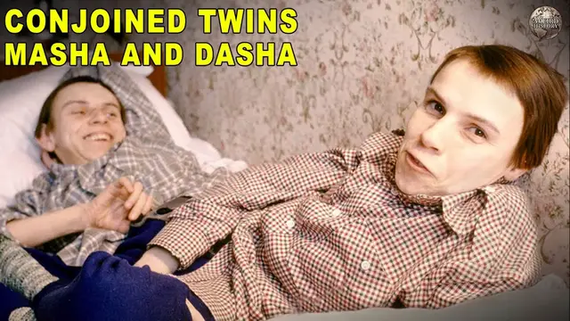 'Video thumbnail for How Conjoined Twins Ended Up Taking Very Different Life Paths'