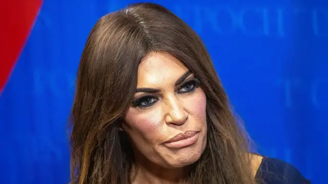 'Video thumbnail for Kimberly Guilfoyle's Worst Looks Just Scream Plastic Surgery'