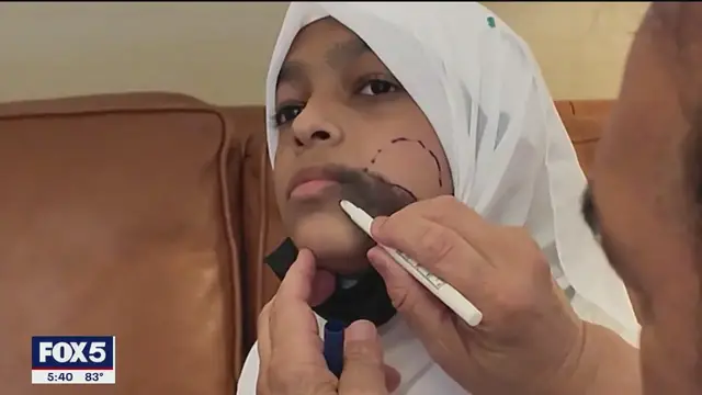 'Video thumbnail for Free facial surgery gives teen a new chance at life'