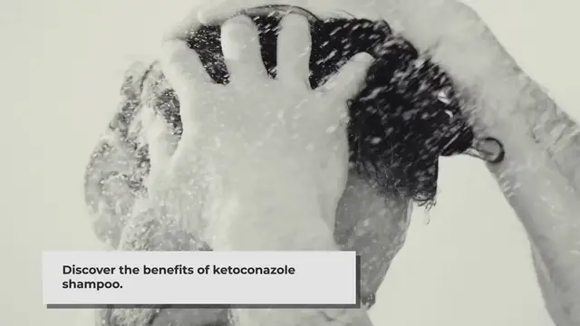 'Video thumbnail for Ketoconazole Shampoo: Benefits and Side Effects Explained'