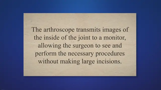 'Video thumbnail for Exploring the Benefits and Process of Laparoscopic Arthroscopy Surgery: A Comprehensive Guide to Recovery and Aftercare'