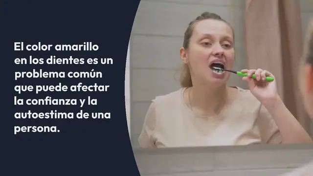 'Video thumbnail for Este remedio casero disminuye el color amarillo de los dientes'